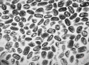 poxvirus - molluscum contagiosum poxvirus - molluscum contagiosum